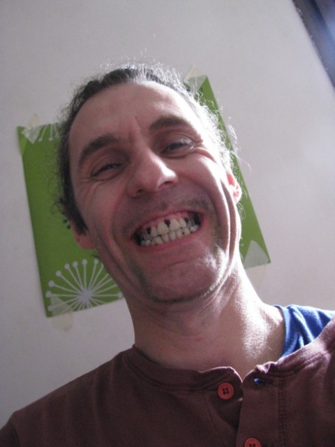 caries.jpg